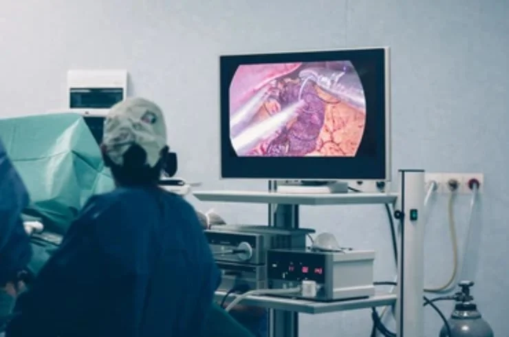 Laparoscopic Gastric Bypass
