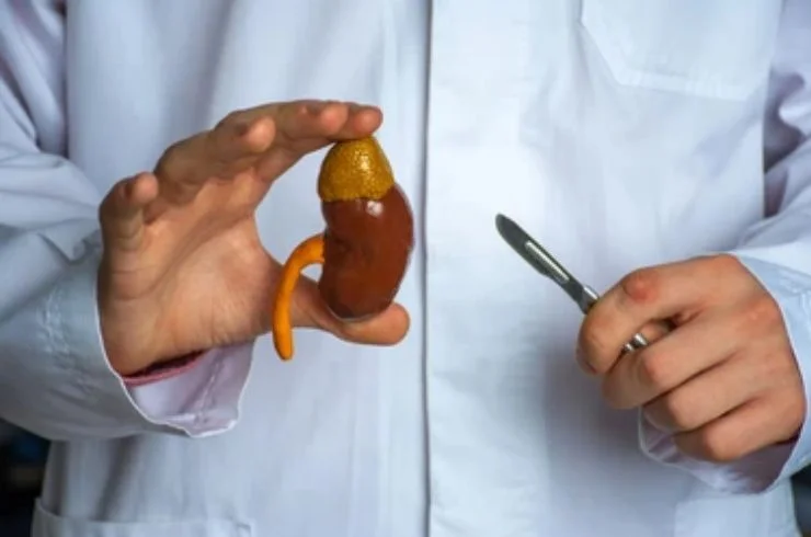 Nephrectomy