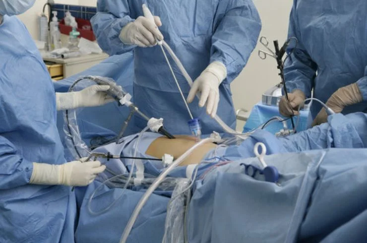 Laparoscopic Myomectomy